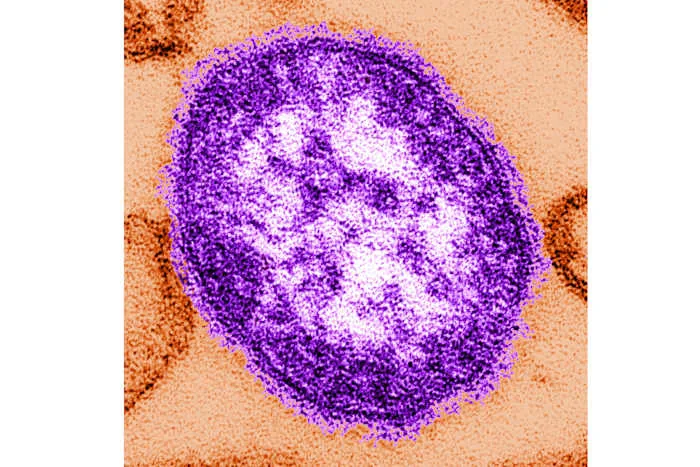 Pennsylvania Coroner Says One Infant Measles Death Was Virus Caused as Outbreak Tops 620 Cases Across 37 Counties Amid CDC Review